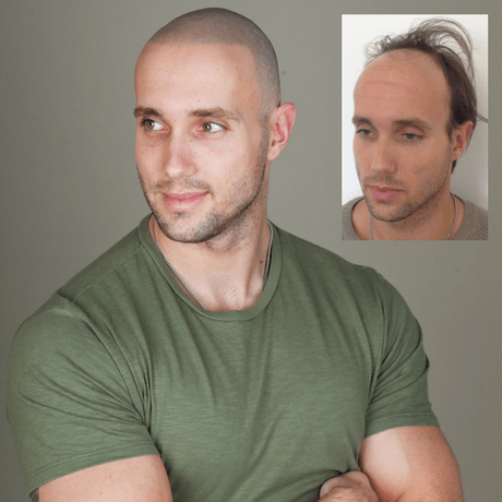 Male shaved head Head shaving