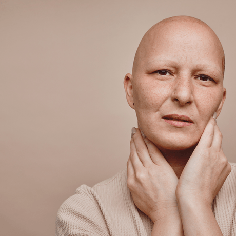Woman with hair loss