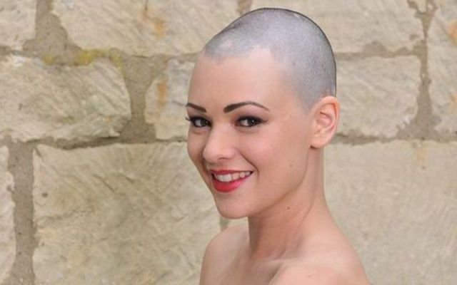 Scalp Micropigmentation