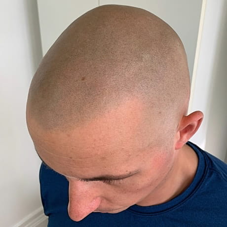 After SMP Healed examples