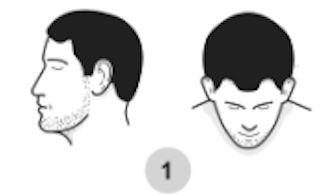 The 7 Stages Of Male Pattern Baldness Explained - Skalp
