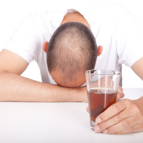 Depressed man with hair loss, bald head and drinking