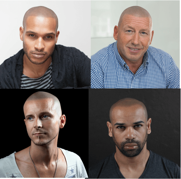 collage of scalp micro pigmentation results 