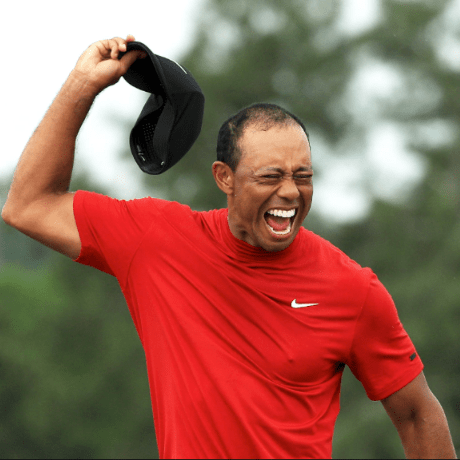 Tiger Woods Hair Loss 2019