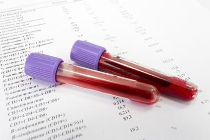 Red blood in test tubes on white blank with results in colums. The results are written in Russian.