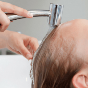 top causes of hair loss and thinning hair