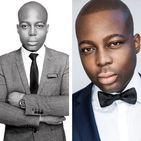 celebrities with smp scalp micro pigmentation