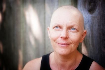 Portrait of a woman balding from cancer treatment smiling and looking up.