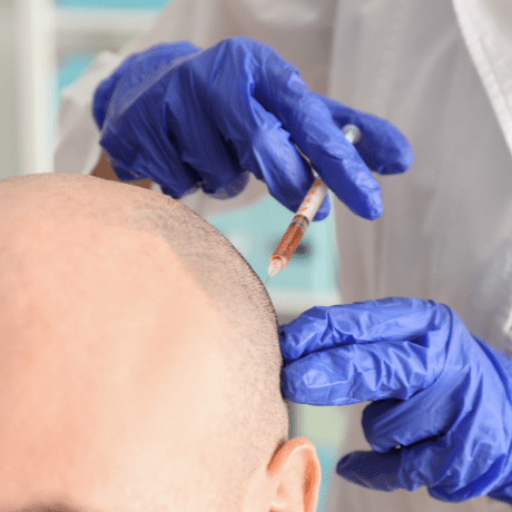 Will there be a cure for hair loss?