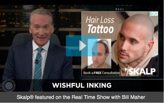 hair-loss-tattoo-today-show