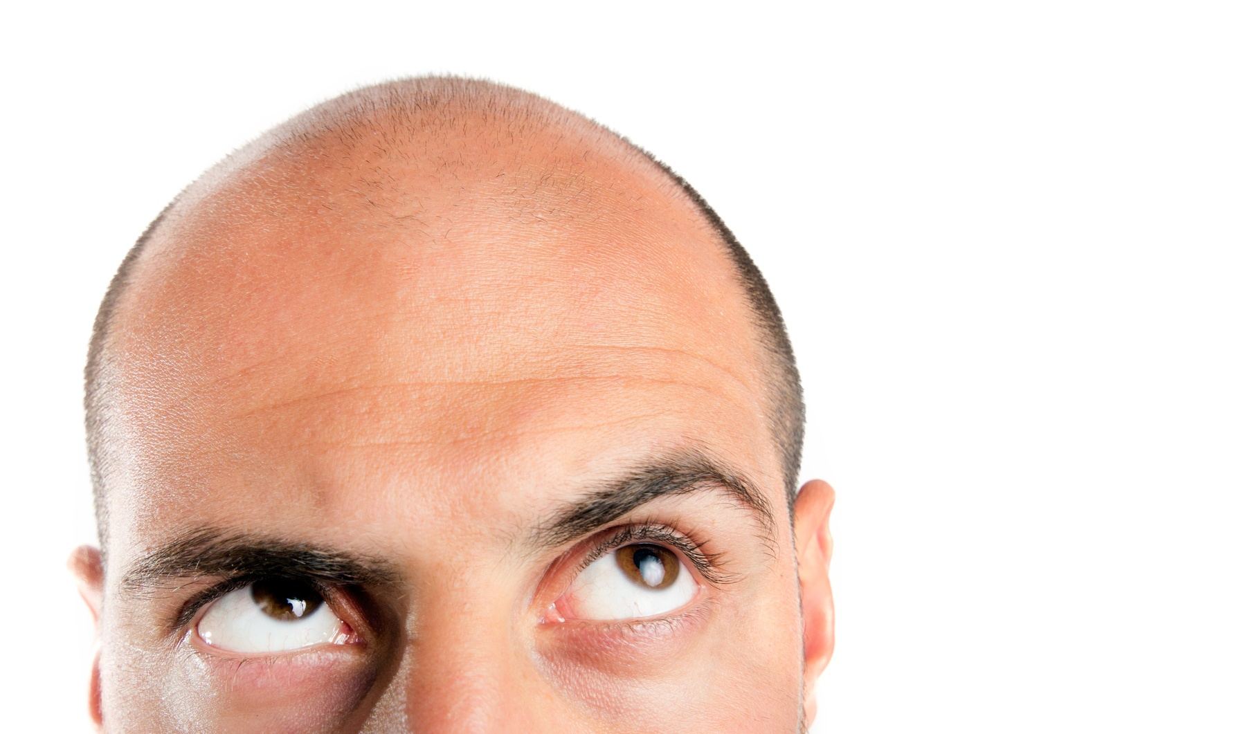 Considering getting temporary scalp micropigmentation for your bald head?