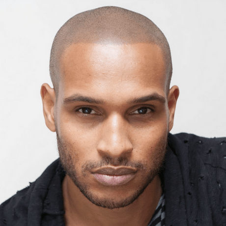 benefits of hairline micropigmentation in nyc at skalp usa