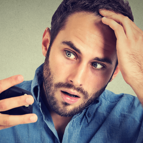 man looking anxious about thinning hair and hair loss