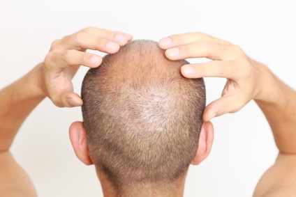 head with partical balding head massage