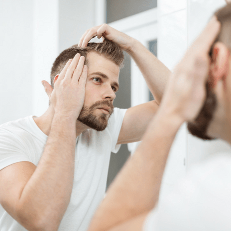 can you prevent male pattern baldness