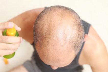 how to get a healthy scalp - Scalp care