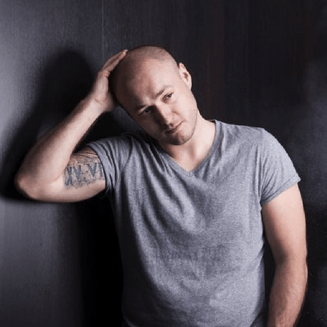 Does stress affect your hairline? Photo of man with receding hair looking distressed