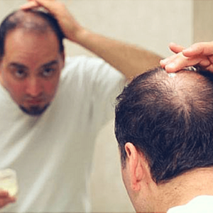 tips for a healthier scalp for bald people