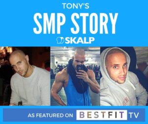 tony skalp transformation story as featured on best fit tv