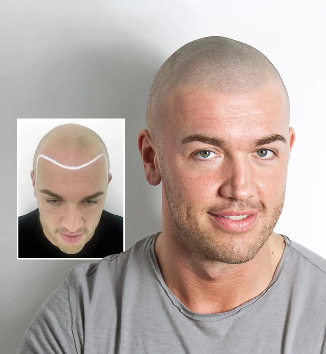 Bald man get... - Head'Lines Unisex Salon & Tattoo Studio | Facebook