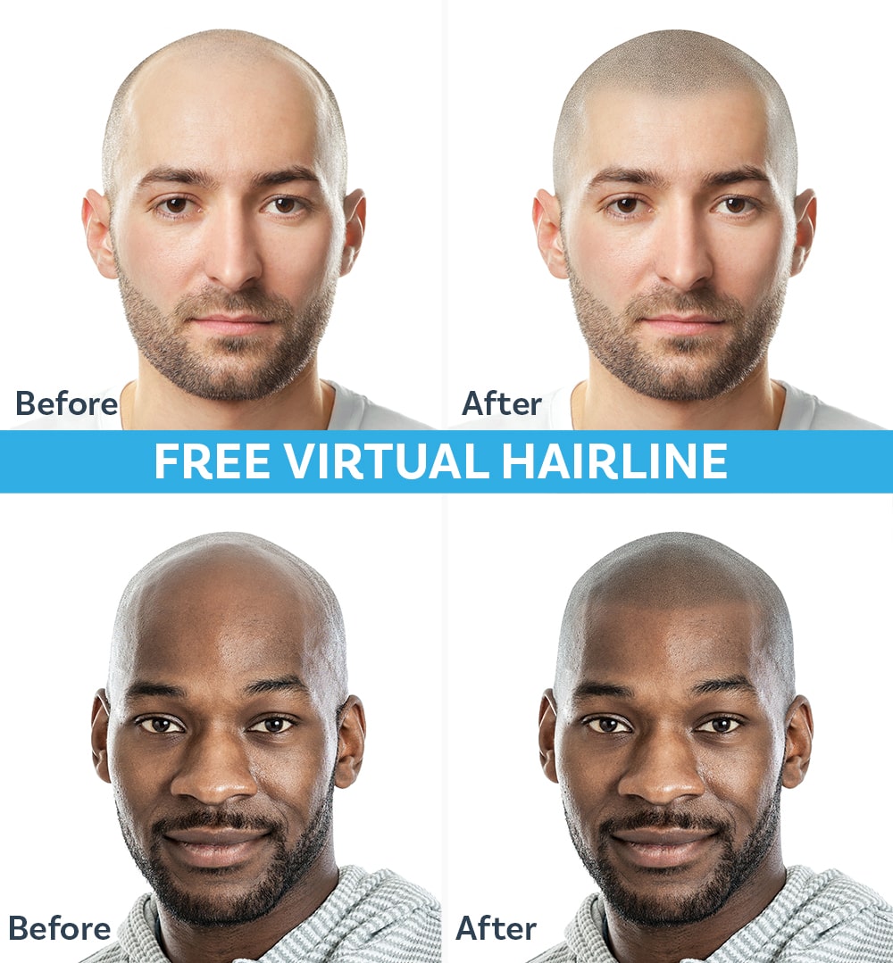 Free Virtual Hairline Mockup