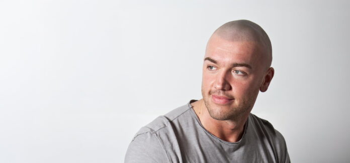 Scalp Micropigmentation Manchester