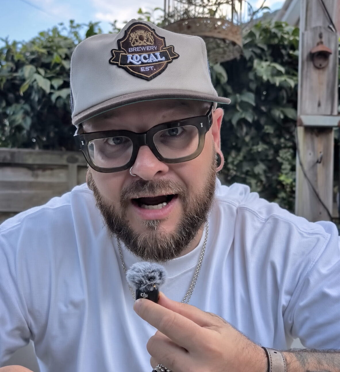 Sam explains that his hair started receding when he was around 18