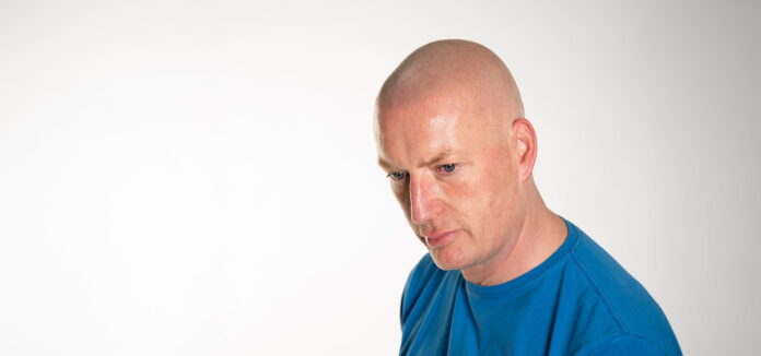 Scalp Micropigmentation London