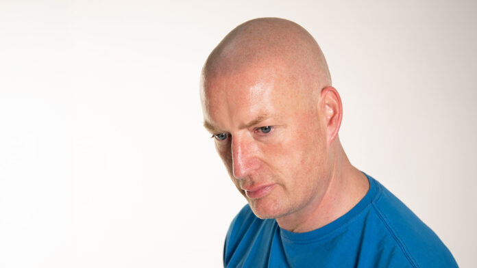 Scalp Micropigmentation London