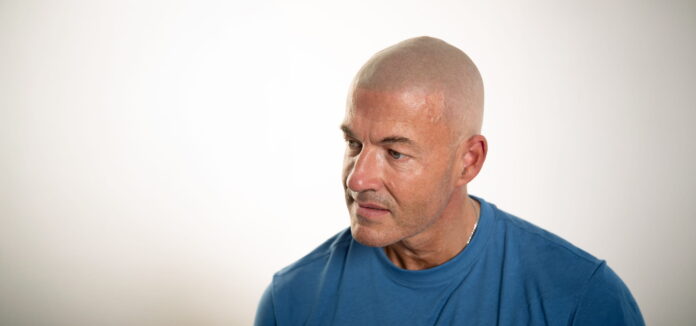 Scalp Micropigmentation Los Angeles